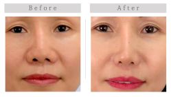 -SKINIST丽铂医疗美容
