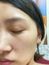 体验后-重庆军科整形美容医院