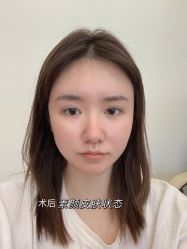 -大华韩艺整形美容医院