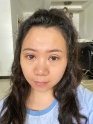 -素美医疗美容·西南眼鼻整形·修复基地