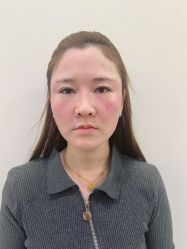 -海涛医疗美容·面部抗衰·注射美鼻