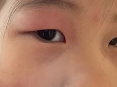 -南京医科大学眼科医院