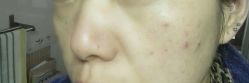 -MedSkinCare科技祛痘肌肤修护中心