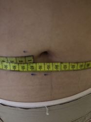 -肥三针腧穴瘦身馆