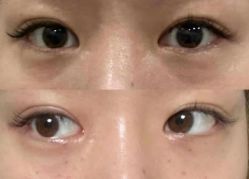 点击看大图 -Yestar艺星医疗美容医院