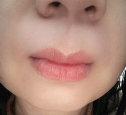 体验后-北京博泽医疗美容门诊部