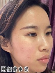 -新美荟医美·专注面部美学抗衰