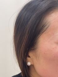 点击看大图 体验后-BR光电保养