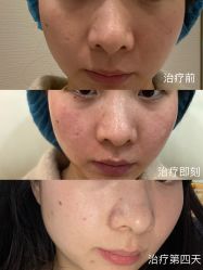 -成都艾特他整形外科医院