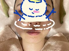 -FACE·日本小颜美容整骨(福田店)