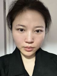 -广州健丽·去眼袋医疗美容机构