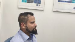 -大麦微针植发全国连锁