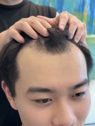 -唐风采假发补发定制
