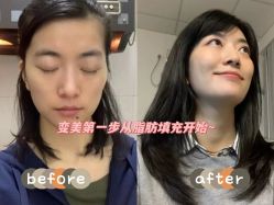 -温州伯思立医院
