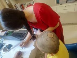 -大麦微针植发丨全国连锁