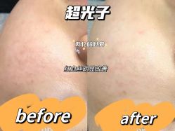 -广州美莱医疗美容医院