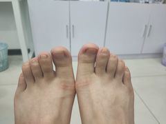 -世龙世家甲沟炎·灰指甲·嵌甲矫正·修脚(武侯区双楠店)