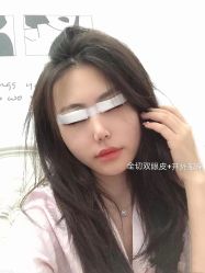 点击看大图 体验前-上海漾颜医疗美容