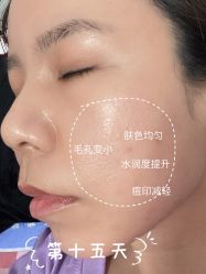 -亿美医疗美容·半岛大超炮官方授权店