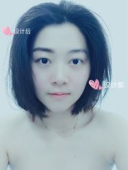-紫御国际抗衰ZOE ANTI AGING