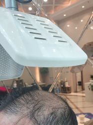 -碧莲盛·不剃发植发