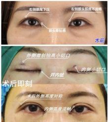 -丰联丽格医疗美容·联合丽格眼整形中心