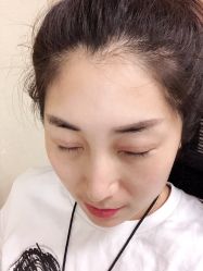 -八大处整形