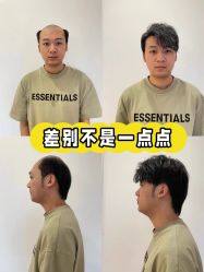 -唐风采假发补发定制