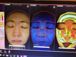 皮肤诊断-光SPA科技美肤