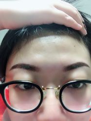 体验后-坤如玛丽·医疗美容中心