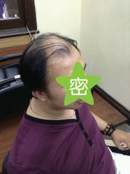 客人-髻尚坊增发补发织发假发定制