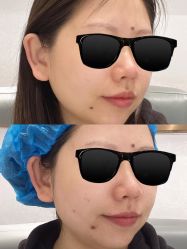 体验前-武汉颜范薇美医疗美容门诊部