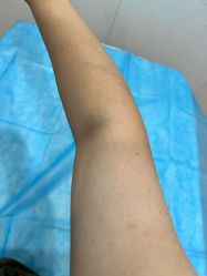 体验后-郑荃丽格医疗美容