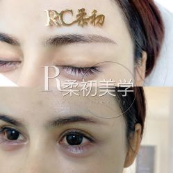 -RC半永久纹眉纹发际线