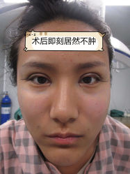 -素美医疗美容·西南眼鼻整形·修复基地
