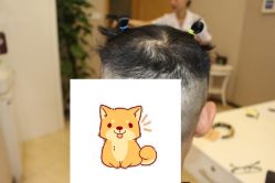 -大麦微针植发丨全国连锁