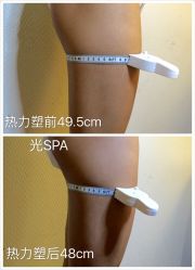 光SPS热力塑瘦身-光SPA科技美肤