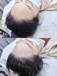 -西施无菌半永久纹绣眉眼影唇轻增发纹发际线