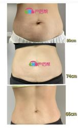 -产后帮产后修复(首城国际店)