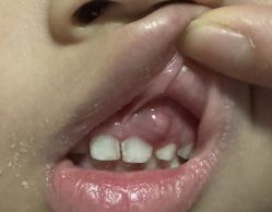 -首都医科大学附属北京儿童医院