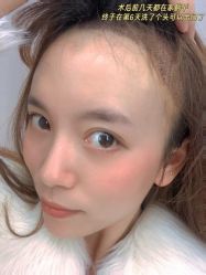 -雍禾植发全国连锁