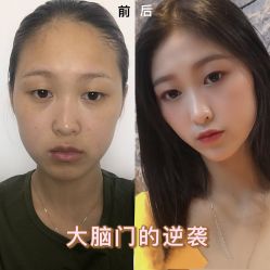 点击看大图 -新生植发·植养护一体