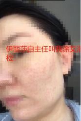 体验后-伊丽莎白医疗美容