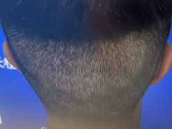 -雍禾植发全国连锁