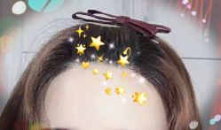 -大麦微针植发全国连锁