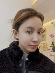 体验后-海涛医疗美容·面部抗衰·注射美鼻