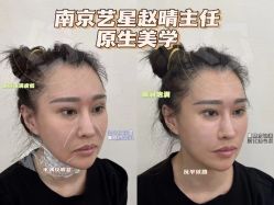 -Yestar艺星医疗美容医院