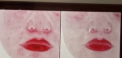 -苑苑vbeauty科技美容SPA