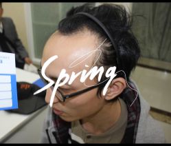 点击看大图 -大麦微针植发全国连锁