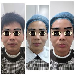 -海涛医疗美容·面部抗衰·注射美鼻